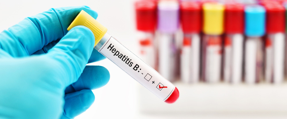 Menene Hepatitis B? Menene alamomi da hanyoyin magani?